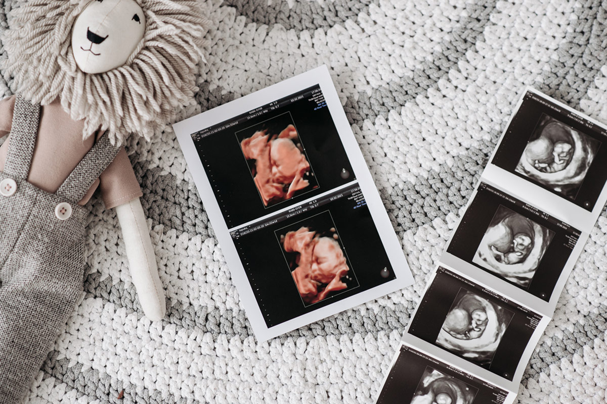 ultrasound-images-lying-near-toy